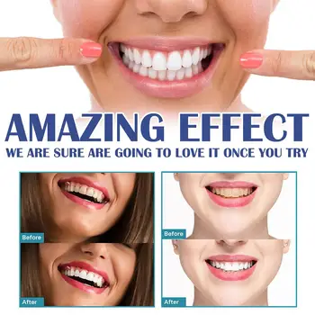 Dişeti Bakım Jeli Dişeti Durgunluğunu Hafifletir Diş Eti İltihabı Tedavisi Diş Beyazlatır Ve H5G8